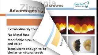 Zirconia crowns vs Porcelain Metal Crowns PMC [upl. by Mckeon897]