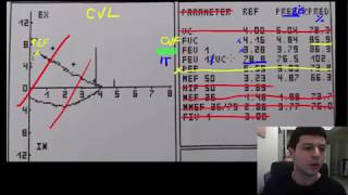 Spirometrie 2  valorile esentiale de urmarit pe o spirometrie [upl. by Ivar]