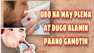 Ubo na may plema at dugo paano gamotin  how to cure bloody phlegm  bloody sputum [upl. by Bibah]