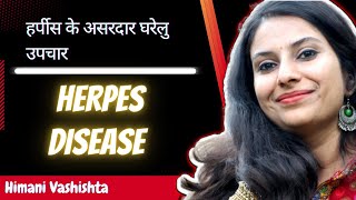 हर्पीस के असरदार घरेलु उपचार ।। Home remedies for herpes disease in Hindi 2022 [upl. by Eliseo154]