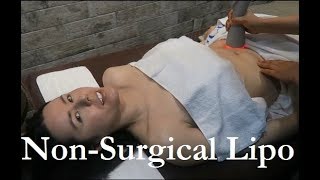 Korean Nonsurgical Liposuction  Seoul Guide Medical [upl. by Jude890]