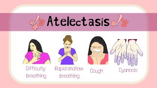 Atelectasis Hindi animated Atelectasis hindi [upl. by Nussbaum]