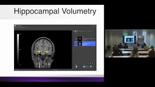 Neuroimaging Biomarkers for Alzheimers Disease [upl. by Themis]