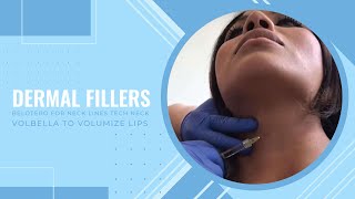 Dermal Fillers Belotero for Neck Lines TECH NECK  Volbella to Volumize Lips  DR JASON EMER [upl. by Ceporah366]