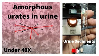 Amorphous urates in urine  pH 6 Amorphous urates in microscope [upl. by Rick]