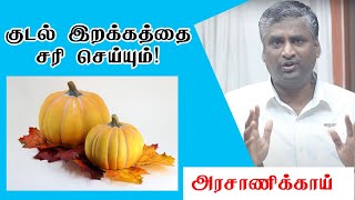 குடல் இறக்கத்தால் அவதியா  Tips to cure hernia naturally  Samayam Tamil [upl. by Paza]