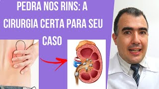 Cirurgia de pedra nos rins qual a melhor escolha para seu caso [upl. by Arat]