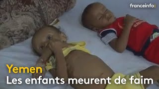 Yémen  les enfants meurent de faim  franceinfo [upl. by Tebazile]