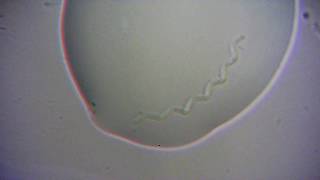 Incredible Footage Of Spirochete Bacteria 2500X [upl. by Anirt]