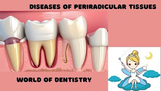 Diseases of periradicular tissues  BDS PERIODONTOLOGY [upl. by Attegroeg777]