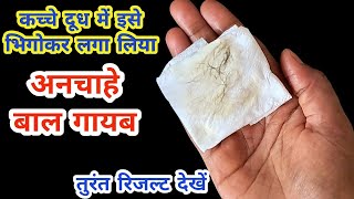 दाढ़ीमूंछ की ग्रोथ कैसा भी हो😱रात को इसे लगा लो🤔 facial hair treatment inHindi [upl. by Eniamret]