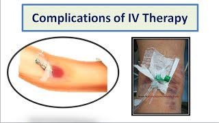 Complications of IV Therapy [upl. by Ciprian]