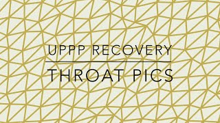 UPPP Patient Recovery Throat Pics [upl. by Mcnutt900]