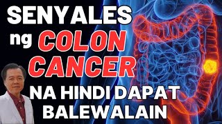 Senyales ng Colon Cancer na Hindi Dapat Balewalain  By Doc Willie Ong Internist and Cardilogist [upl. by Bevan]