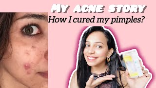 ✨ How to cure Pimples  Acne Treatment ✨ [upl. by Alra344]