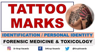 Tattoo Marks  Identification  Dr Krup Vasavda [upl. by Nuajed]