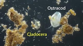 Cladocera Chydoridae with eggs and babies plus size compared to Ostracods [upl. by Corson928]