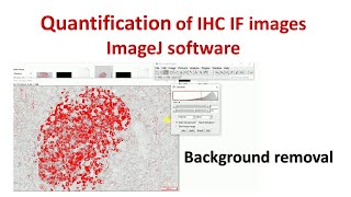 Quantification of Immunohistochemistry images using ImageJ  How to remove background in ImageJ [upl. by Tobi]