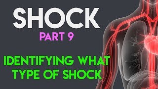 Identifying What Type Shock  Shock Part 9 [upl. by Wiltshire]