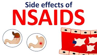 NSAIDs side effects in easy way [upl. by Enela700]