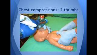 Resuscitation of Newborn Infants [upl. by Estey205]