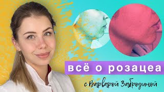 Все о Розацеа Rosacea  Доказательная медицина [upl. by Ahtoelc]