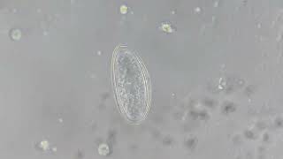 Egg of Pinworm in Urine Microscopy [upl. by Anelat735]