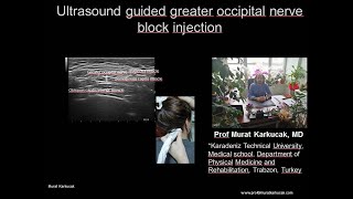 Ultrasound guided greater occipital nerve block injection [upl. by Wasserman]