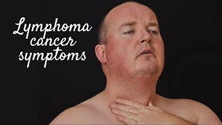 LYMPHOMA CANCER SYMPTOMS [upl. by Einotna221]