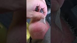 Sunburn ASMR Skin Peeling ASMR sunburn skinpeel asmr [upl. by Petersen97]