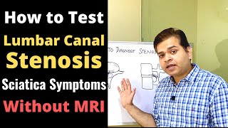 Lumbar Canal Stenosis Foraminal Stenosis How to Diagnose Stenosis Disc Bulge amp Sciatica Symptoms [upl. by Yllor]