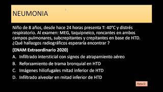 Taller de casos Pediatría 4 [upl. by Imalda]