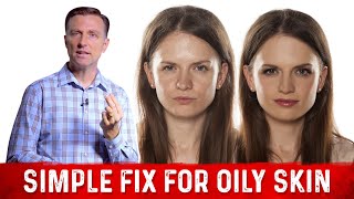 How To Fix Oily Skin With Simple Hack – Dr Berg [upl. by Farand]