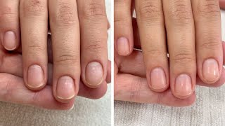 Results are in From cutting the skin fold to gentle manicures 3 week progress [upl. by Letram]