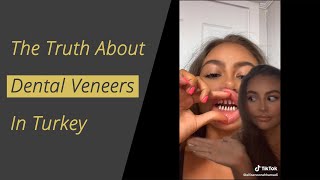 The Truth about Dental Veneers in Turkey [upl. by Aratak765]