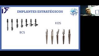 Webinar Introducción a la Implantología Estratégica  Dr Andrés Romero Vargas [upl. by Hsoj836]