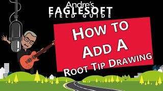 Eaglesoft Training How Andre Draws a Custom Root Tip [upl. by Elyk]