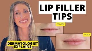 Dermatologist Shares 9 Lip Filler Tips to Know Before and After Treatment [upl. by Aehsila493]