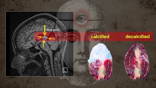 I finally decalcified my pineal gland Heres how [upl. by Enahpets]