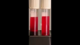 Hypotonic Hypertonic and Isotonic Solutions  What happens to a red blood cell [upl. by Apilef]