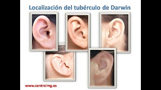 52 Localización del Tubérculo de Darwin Cursos Auriculoterapia Centro IMG [upl. by Eivi]