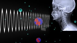 How Do Xrays Work [upl. by Nelloc708]