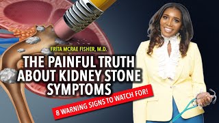 The Painful Truth About Kidney Stone Symptoms 8 Warning Signs to Watch For [upl. by Waylon]