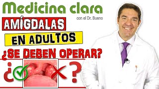 AMÍGDALAS EN ADULTOS ¿Se deben OPERAR AMIGDALECTOMÍA  Medicina Clara [upl. by Hobard]