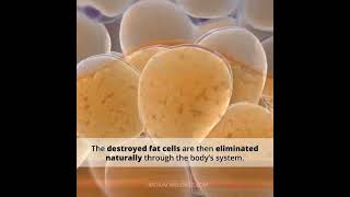 Destroy Up to 25 of Fat Cells with Fat Freeze [upl. by Negroj]