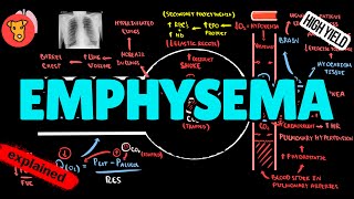 EMPHYSEMA Pathogenesis [upl. by Faunia270]