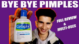 cetaphil gentle skin cleanser  Review How Is Cetaphil Gentle Skin Cleanser For All Skin Types [upl. by Alemap]