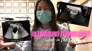 WEEK IN THE LIFE Registered Diagnostic Medical Sonographer  describing ultrasound exams [upl. by Vivl]