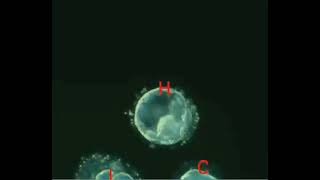 Human blastocyst day 3 to 6 [upl. by Fauver]