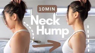 10min Fix Neck Hump amp Forward Head  Correct Posture  Best Neck Stretch [upl. by Thaine]